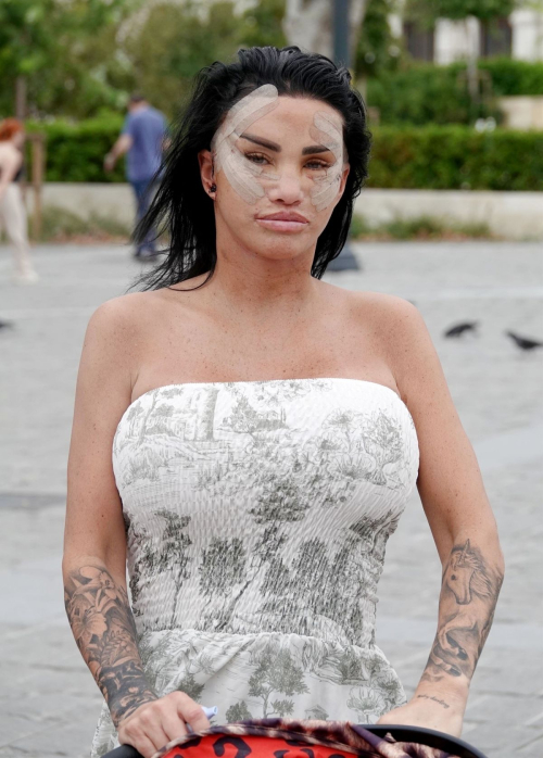 Katie Price Heavily Bruised Face During Turkish Getaway 4