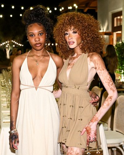 Winnie Harlow photo image 5